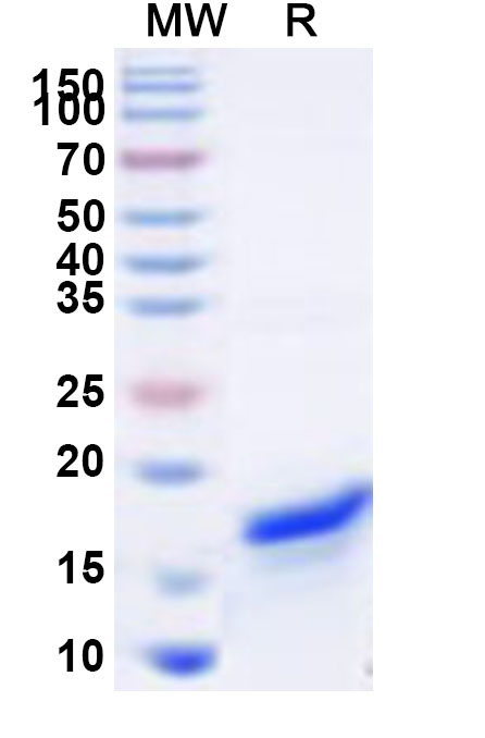 SDS-PAGE for Recombinant Human SLC30A9 Protein, N-His