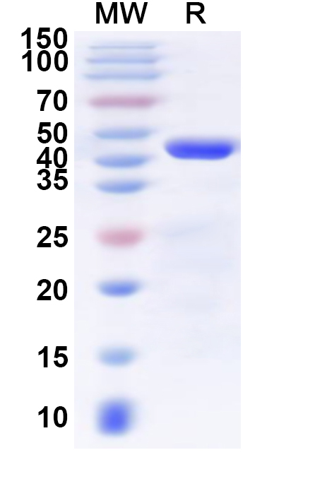 SDS-PAGE for Recombinant Human SLC31A1 Protein, N-GST & C-His