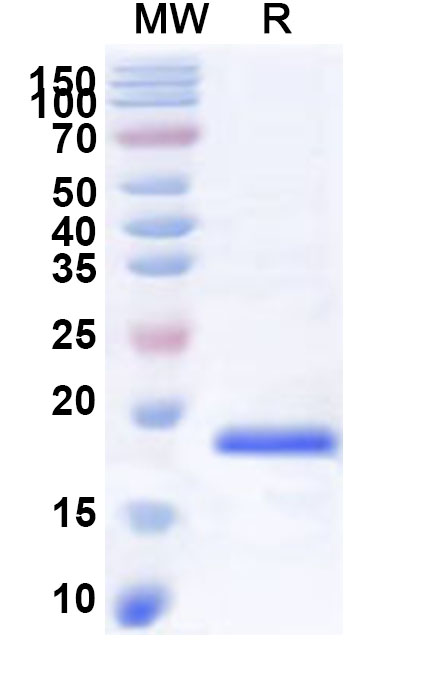 SDS-PAGE for Recombinant Human SLC34A1 Protein, N-His