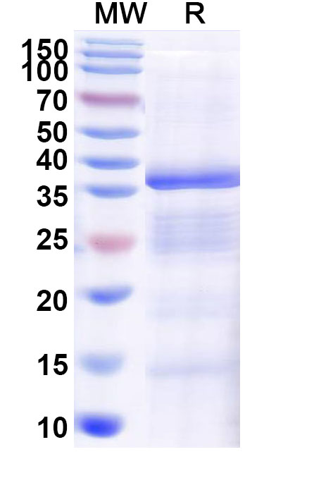 SDS-PAGE for Recombinant Human SLC34A2/NaPi2b Protein, N-GST