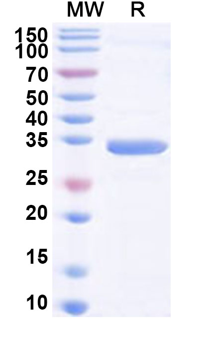 SDS-PAGE for Recombinant Human SLC35A1 Protein, N-GST & C-His