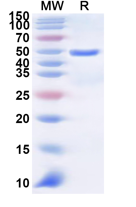 SDS-PAGE for Recombinant Human SLC36A1 Protein, N-GST & C-His