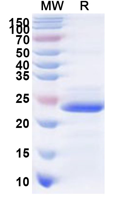 SDS-PAGE for Recombinant Human SLC39A5 Protein, N-His