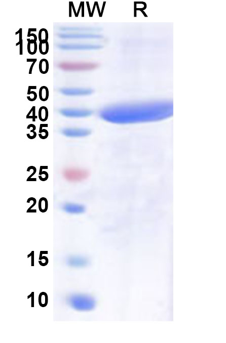 SDS-PAGE for Recombinant Human SLC4A10 Protein, N-His