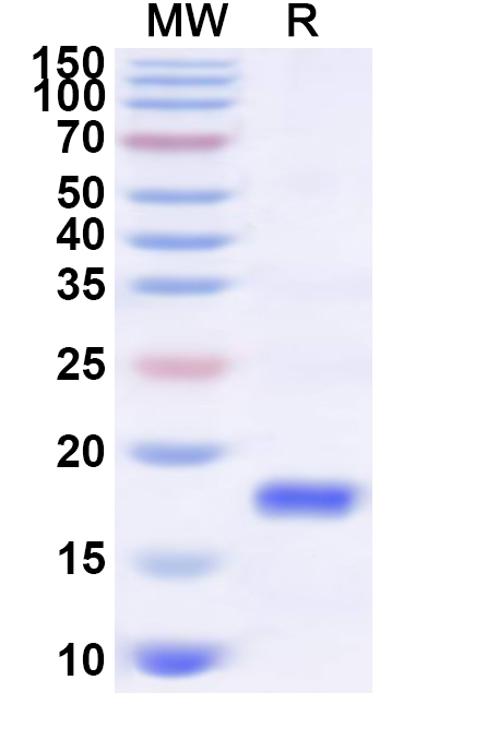 SDS-PAGE for Recombinant Human SLC4A7 Protein, C-His