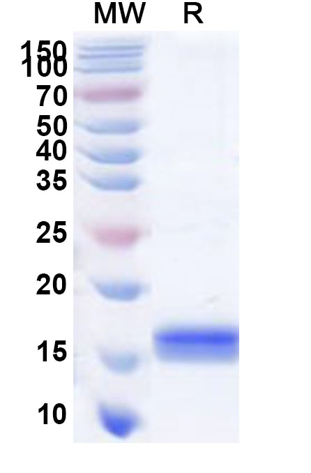 SDS-PAGE for Recombinant Human SLC4A7 Protein, C-His