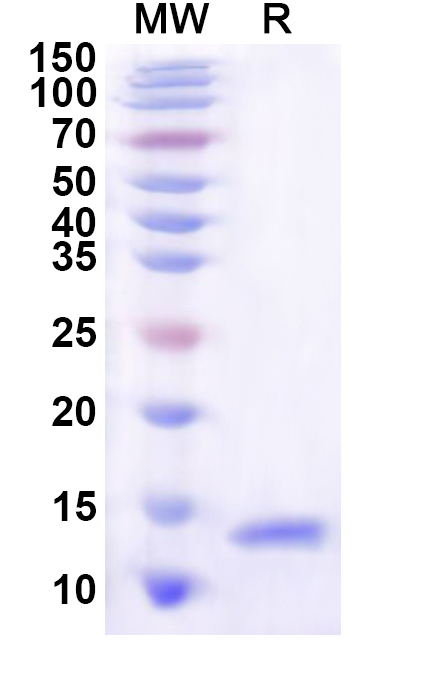 SDS-PAGE for Recombinant Human SLC4A7 Protein, C-His