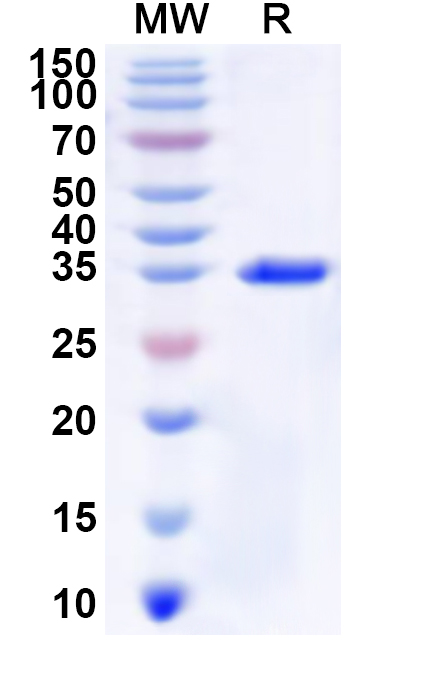 SDS-PAGE for Recombinant Human SLC6A11 Protein, N-GST & C-His