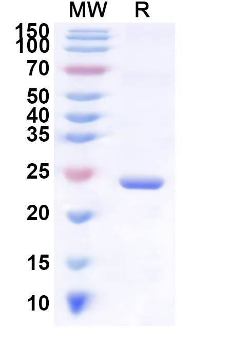 SDS-PAGE for Recombinant Human SLC6A19 Protein, N-His-KSI