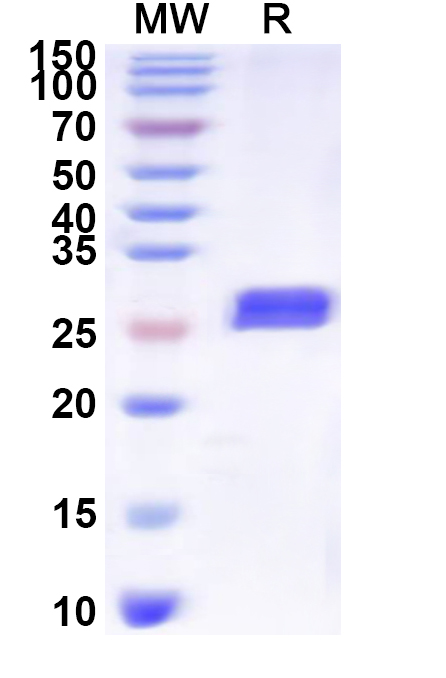 SDS-PAGE for Recombinant Human SLC7A1 Protein, N-His-KSI