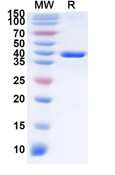 SDS-PAGE for Recombinant Human SLC7A10 Protein, N-GST & C-His