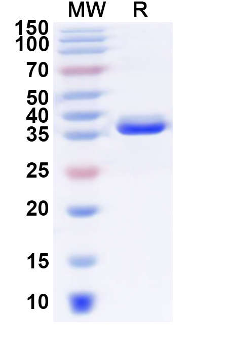 SDS-PAGE for Recombinant Human SLC7A5 Protein, N-GST & C-His