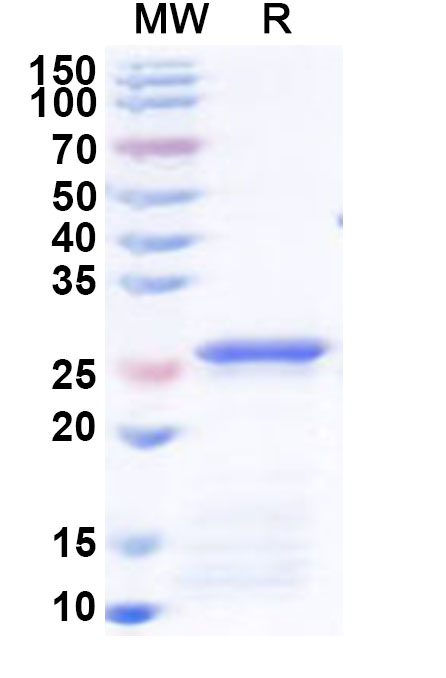 SDS-PAGE for Recombinant Human SMARCA4 Protein, N-His