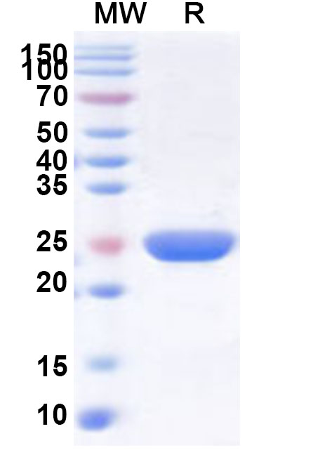 SDS-PAGE for Recombinant Human SMU1 Protein, N-His