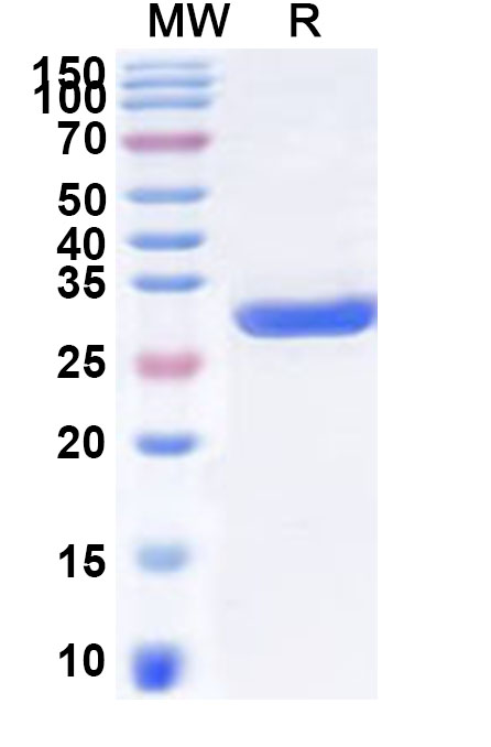 SDS-PAGE for Recombinant Human SMUG1 Protein, N-His