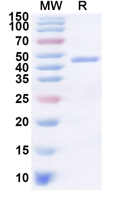 SDS-PAGE for Recombinant Human SMYD5 Protein, N-His