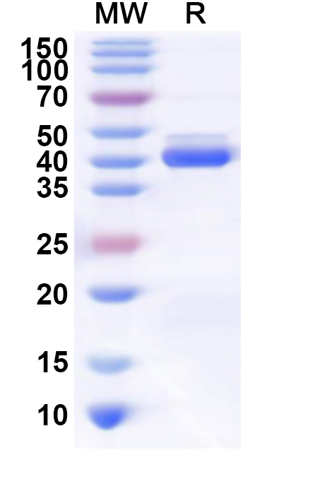 SDS-PAGE for Recombinant Human SNAPC4 Protein, N-His