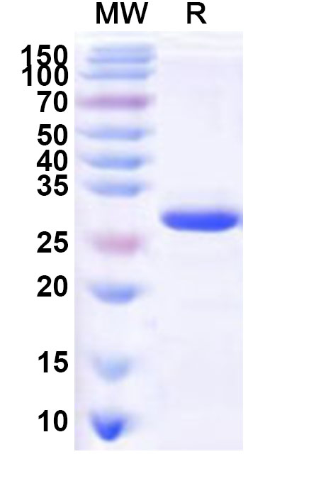 SDS-PAGE for Recombinant Human SNAPC5 Protein, N-His-KSI