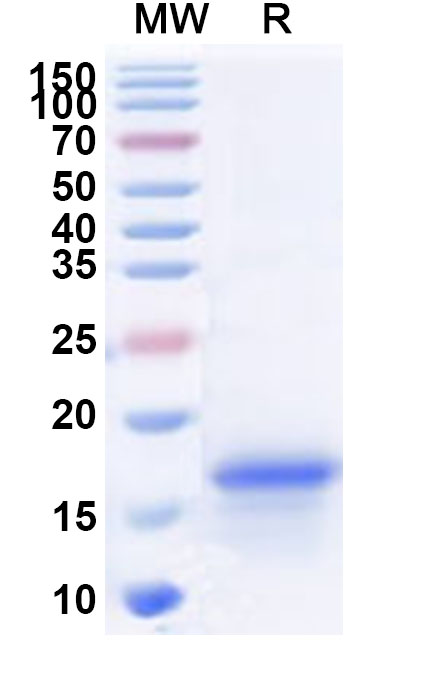 SDS-PAGE for Recombinant Human SNRPD3 Protein, N-His