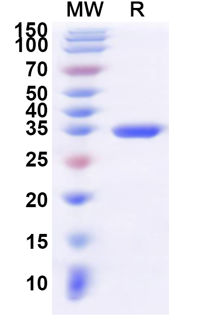 SDS-PAGE for Recombinant Human SNRPG Protein, N-GST & C-His