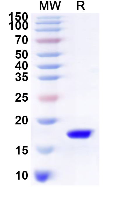 SDS-PAGE for Recombinant Human SNX8 Protein, N-His