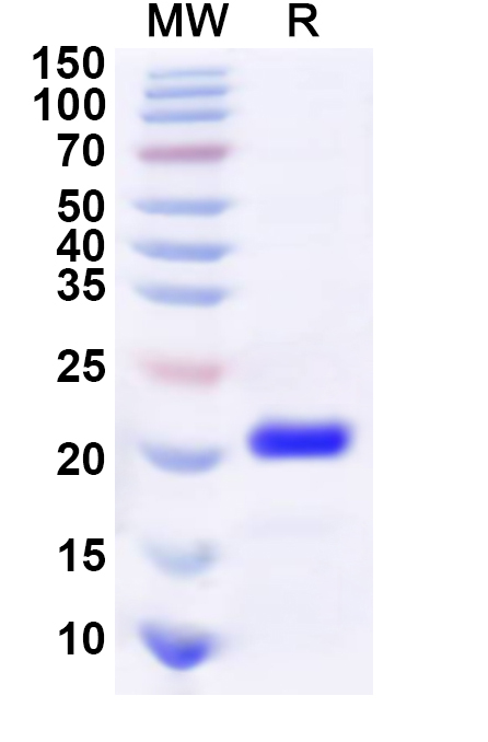 SDS-PAGE for Recombinant Human SOX4 Protein, C-His