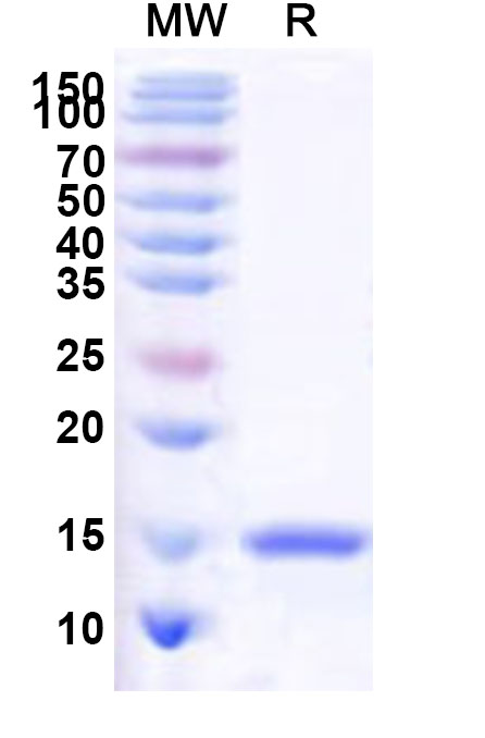 SDS-PAGE for Recombinant Human SP4 Protein, N-His
