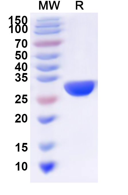 SDS-PAGE for Recombinant Human SPR Protein, N-His