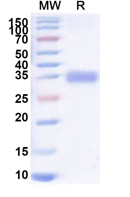 SDS-PAGE for Recombinant Human SPRR1A Protein, N-His-KSI