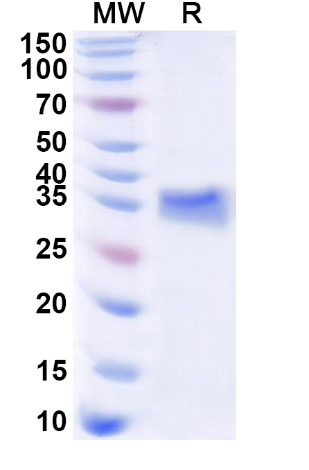 SDS-PAGE for Recombinant Human SPRR2A Protein, N-His-KSI