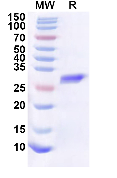 SDS-PAGE for Recombinant Human SRRM4 Protein, N-His-KSI