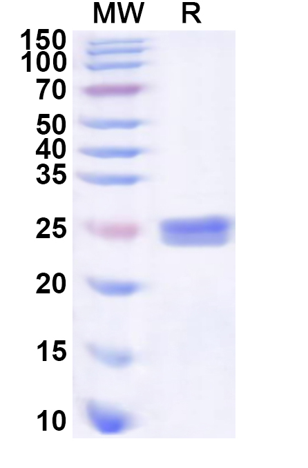 SDS-PAGE for Recombinant Human SRSF11 Protein, N-His