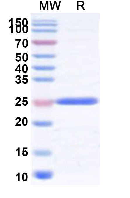 SDS-PAGE for Recombinant Human SRSF5 Protein, N-His