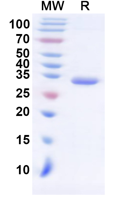 SDS-PAGE for Recombinant Human SS18 Protein, N-His-KSI