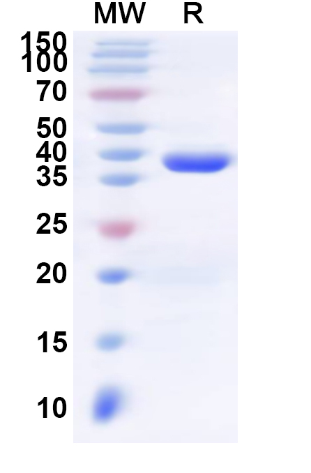 SDS-PAGE for Recombinant Human SSX2 Protein, N-His-KSI