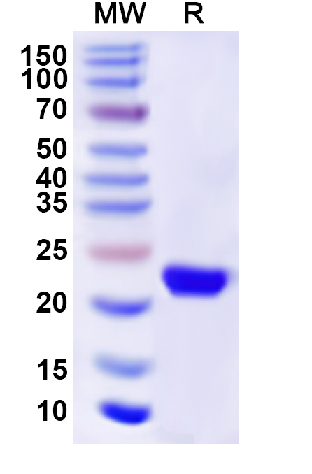 SDS-PAGE for Recombinant Human ST13 Protein, N-His