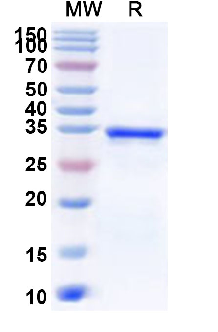 SDS-PAGE for Recombinant Human ST3GAL1 Protein, N-His