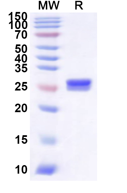 SDS-PAGE for Recombinant Human STARD3 Protein, N-His