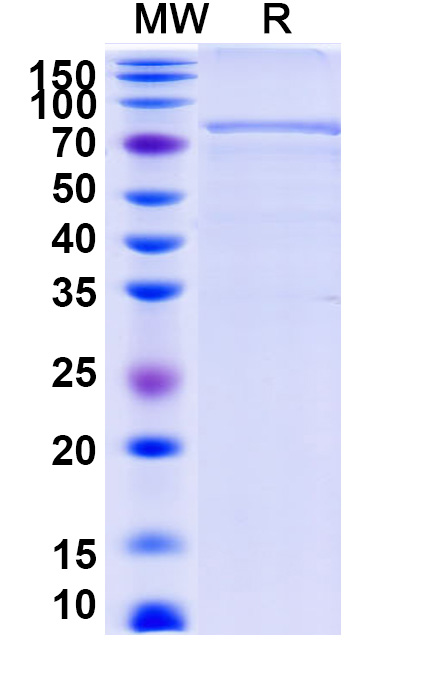 SDS-PAGE for Recombinant Human STAT1, N-His
