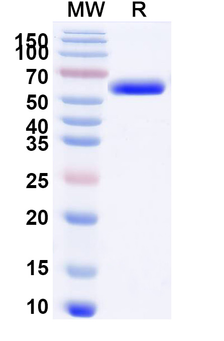 SDS-PAGE for Recombinant Human STK39 Protein, N-His