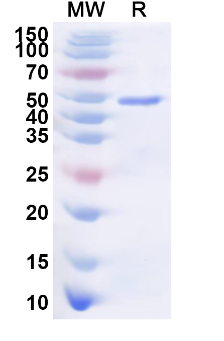 SDS-PAGE for Recombinant Human STRIP1 Protein, N-His
