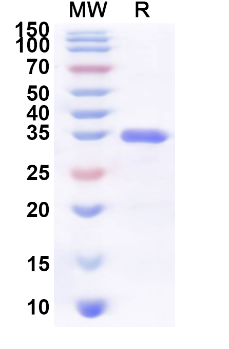 SDS-PAGE for Recombinant Human SULT1C3 Protein, N-His