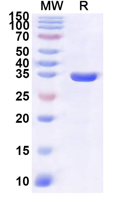 SDS-PAGE for Recombinant Human SULT2A1 Protein, N-His