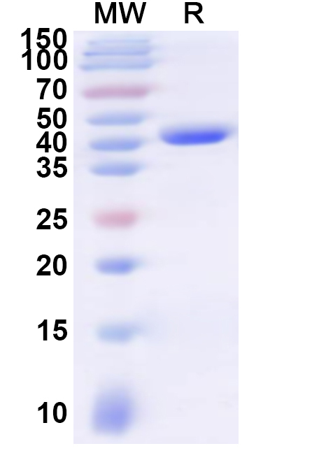 SDS-PAGE for Recombinant Human SURF4 Protein, N-GST & C-His