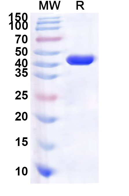 SDS-PAGE for Recombinant Human SYCP1 Protein, N-His