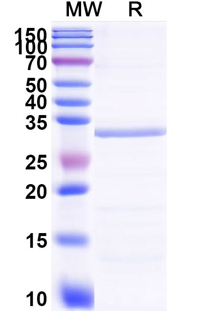 SDS-PAGE for Recombinant Human SYK Protein, N-His