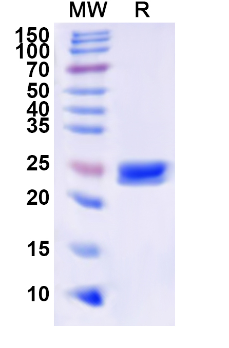 SDS-PAGE for Recombinant Human TACR3 Protein, N-His-KSI
