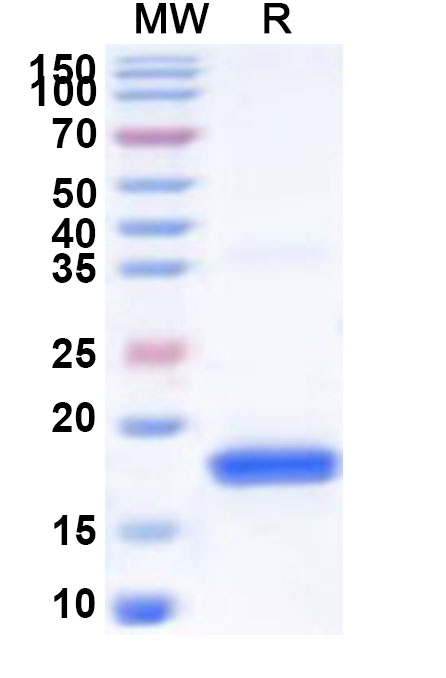 SDS-PAGE for Recombinant Human TAF11 Protein, N-His