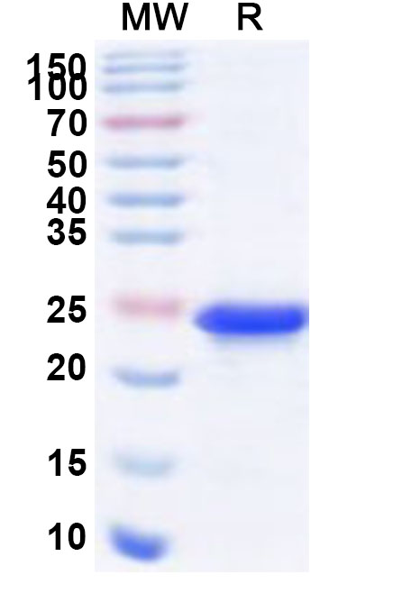 SDS-PAGE for Recombinant Human TAF7 Protein, N-His