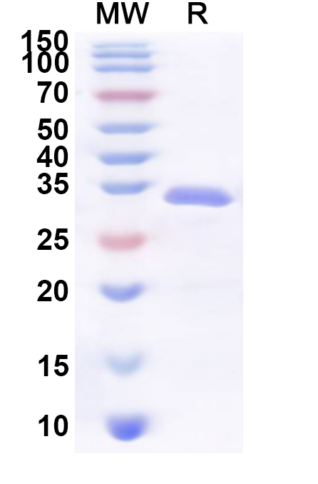 SDS-PAGE for Recombinant Human TANGO2 Protein, N-His